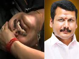 तमिलनाडु के मंत्री सेंथिल बालाजी को ईडी ने किया गिरफ्तार, ICU में भर्ती DMK ने लगाए टॉर्चर के आरोप
