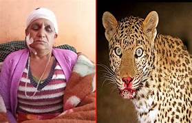 Tehri: महिला पर झपटा गुलदार, तो पालतू कुत्ते ने निभाई वफादारी; खुद लहूलुहान होकर बचाई जान